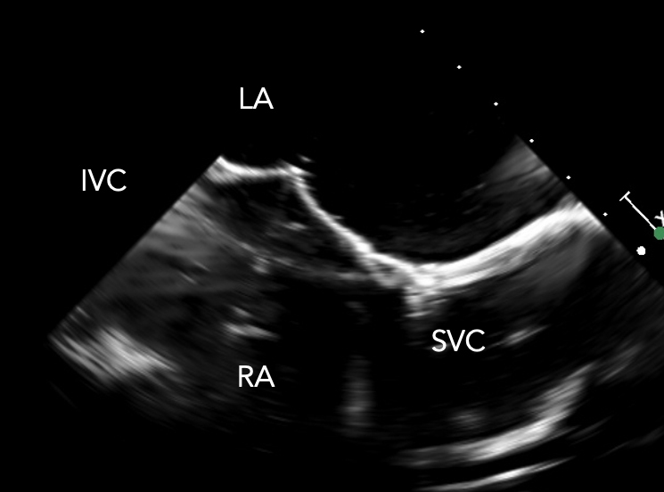 Ultrasound Biomodex