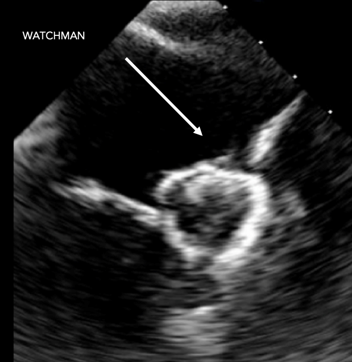 Ultrasound Biomodex